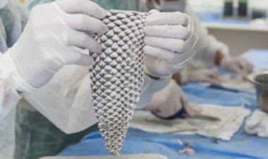 Brasil terá primeira fábrica do mundo de pele de tilápia para tratar queimaduras; entenda tecnologia